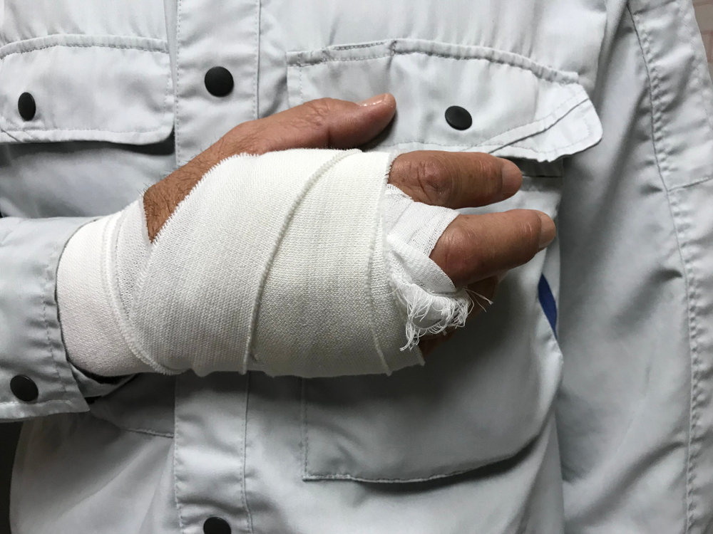Photo of an Injured Worker 